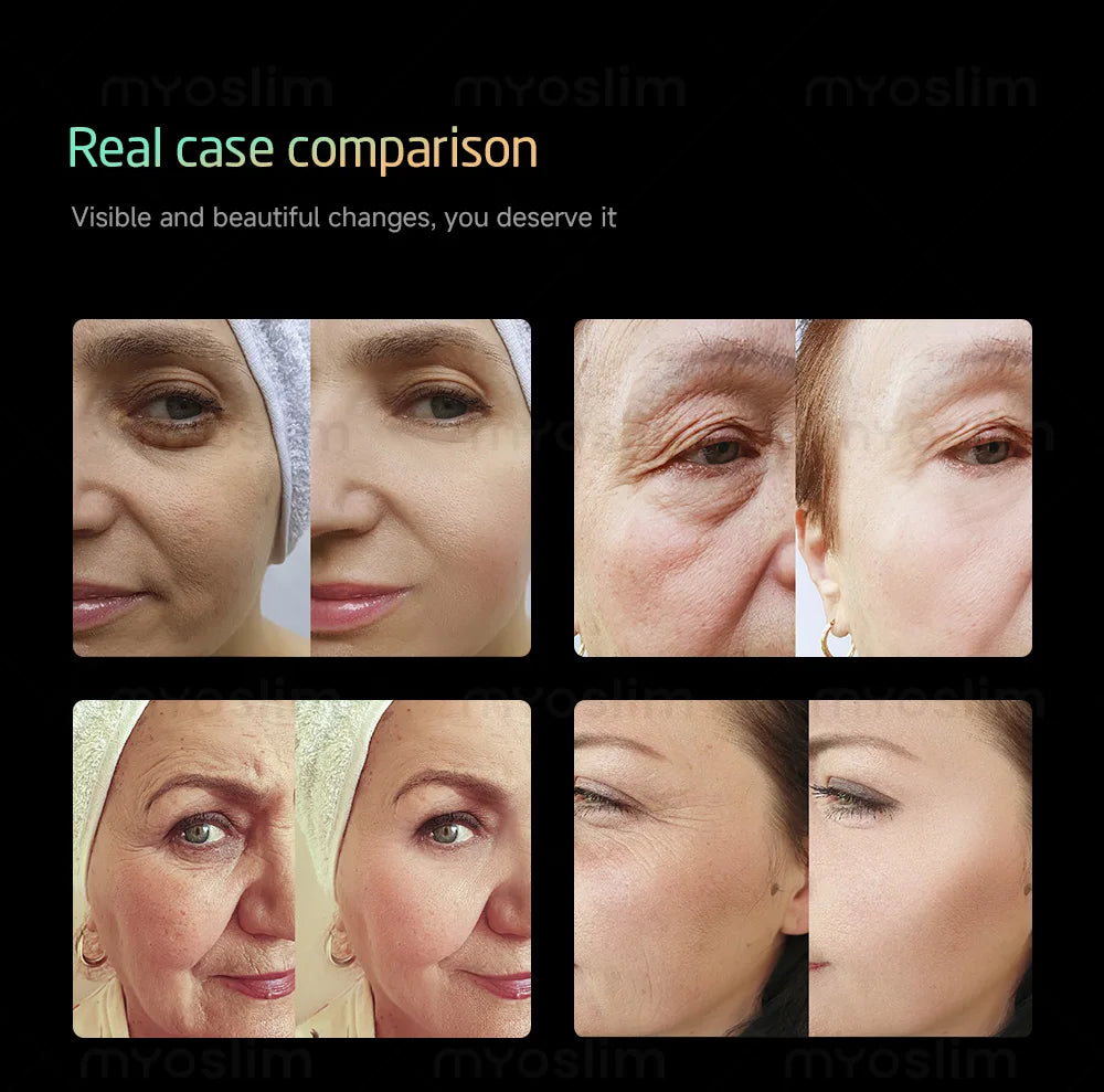 360MAX 25D HIFU 3 In 1 Multi Functional Beauty Equipment Non Invasive Anti Aging Face Lifting Neck Firming Body Shaping Slimming