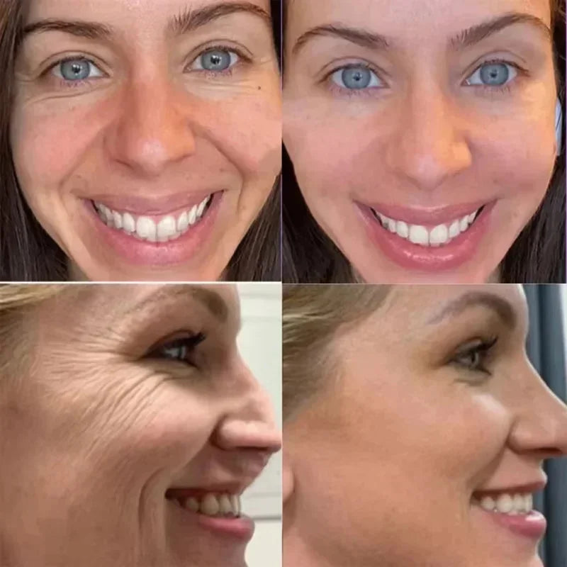 One Stick for Face, Neck, Anywhere Dry – Korean Collagen Balm That Improves Wrinkles and Dullness
